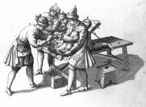 Bladder stones, a 17th century musical