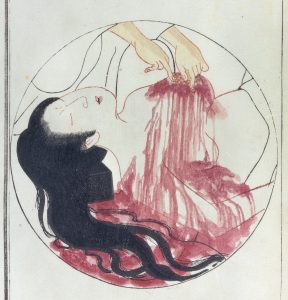 Seven men in black – a mastectomy in 1811